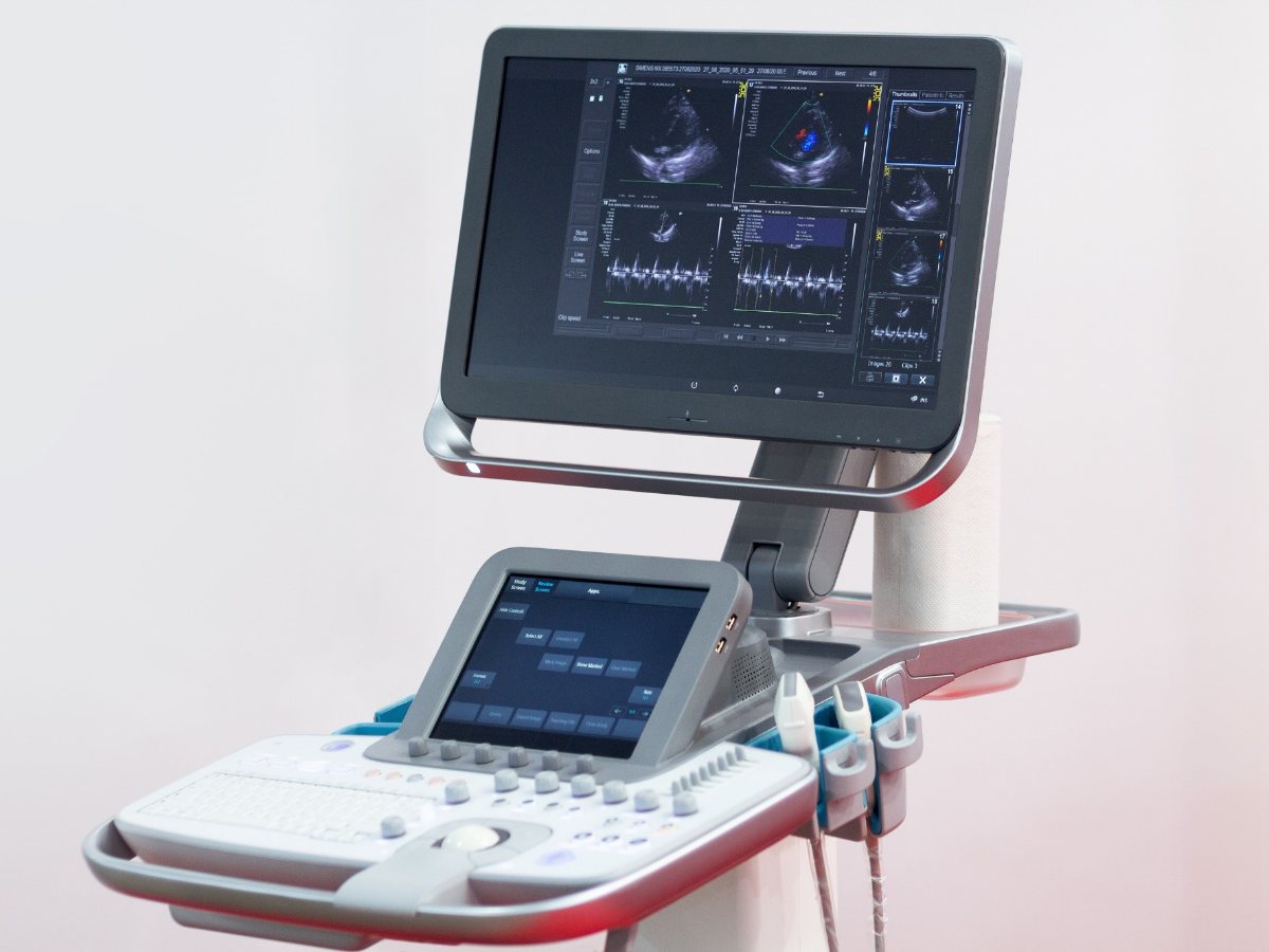 Ultrasound imaging system with a monitor and control panel